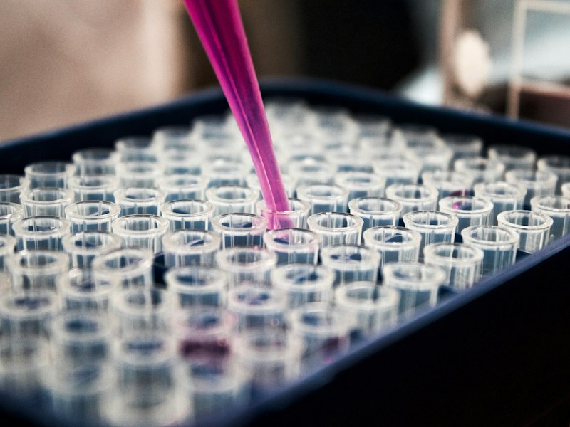 Flujo vaginal: qué es normal y cuándo consultar